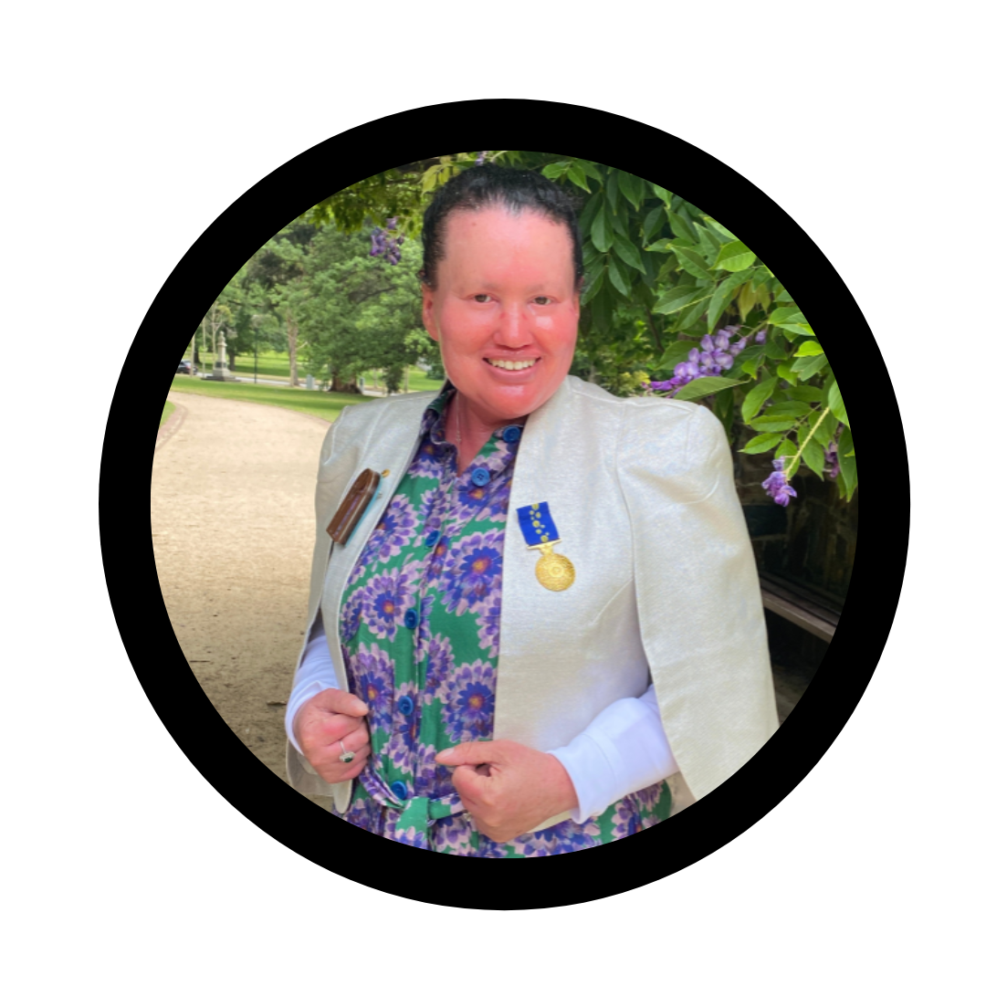 Small circle containing an image of Carly Findlay. She wears a white blazer and patterned shirt. Her Order of Australia Medial is pinned to her jacket.