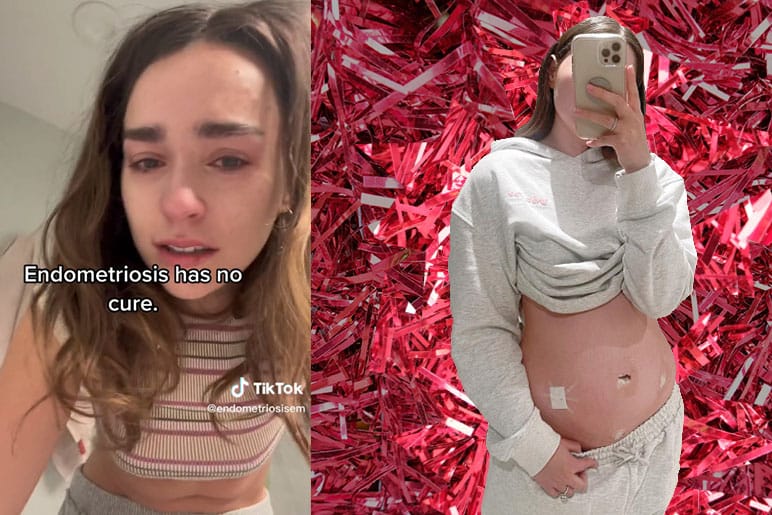 The Psychological Toll of Endometriosis Can Really F*ck You Up